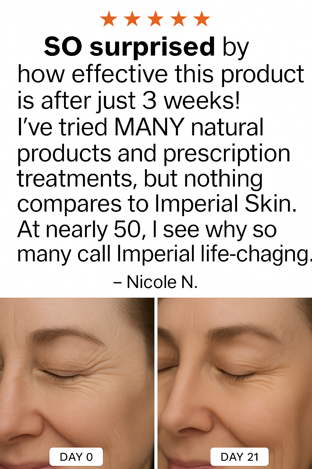 Imperial Skin Ritual – The World's Only Method Against Crow’s Feet for a 9 Years Younger Look